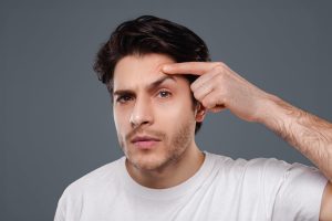 بلفاروپلاستی در مردان