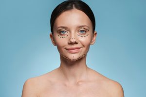 ماندگاری نخ لیفت