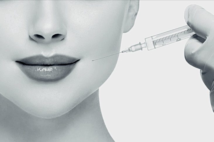 بهترین نقاط صورت تزریق فیلر