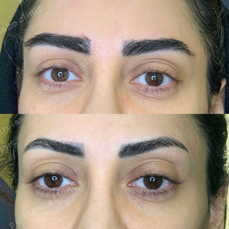 a woman's eyes with a black hoodie