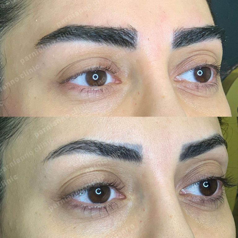 a comparison of a woman's eyes