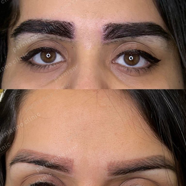 a comparison of a woman's eyes