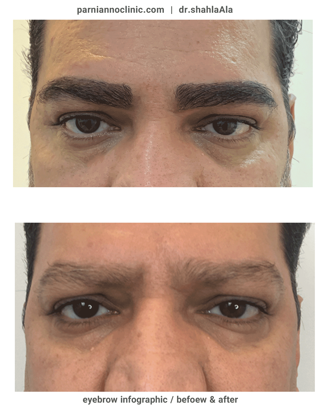 before-after-natural-man-eyebrows