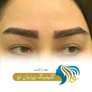 مدل کاشت ابرو برای صورت گرد