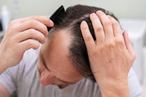 ریسک‌های پنهان کاشت مو