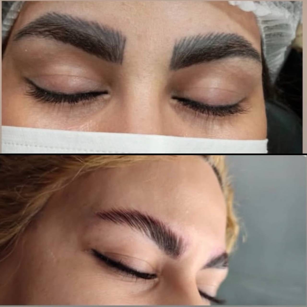 پاک کردن تتو ابرو