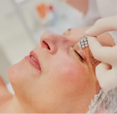 بلفاروپلاستی